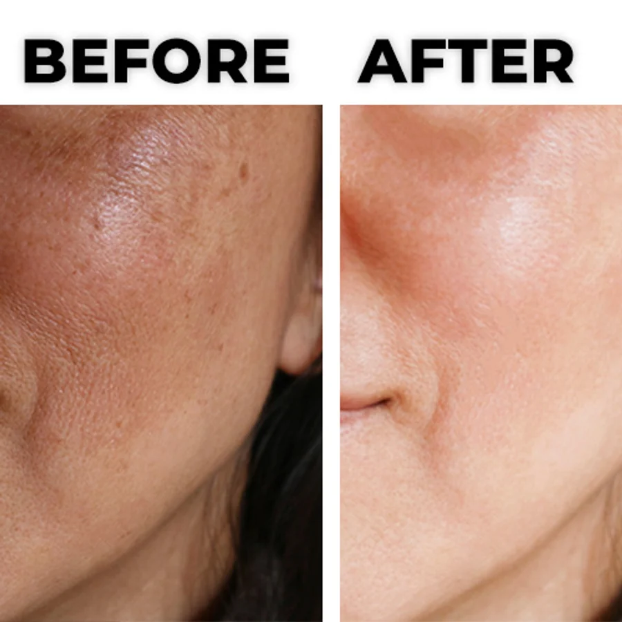 Close-up of skin labeled before and after a cleanse. Results vary.